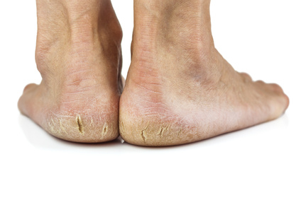 Talons qui craquent hotsell